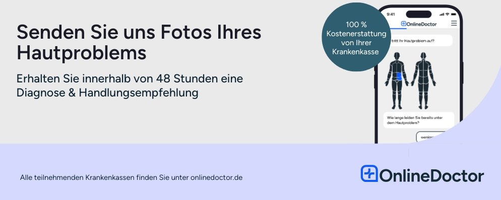 OnlineDoctor – Fotos vom Hautproblem senden
